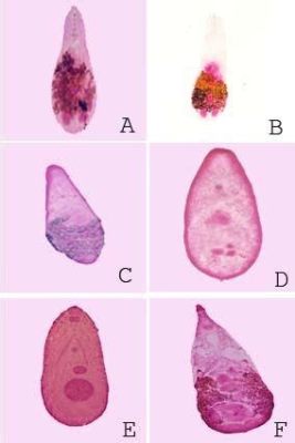  Heterophyes Heterophyes: This Tiny Trematode That Hides in Freshwater Fish Will Make Your Stomach Rumble (and Not in a Good Way!)