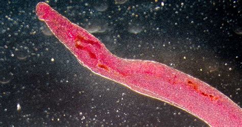  Quirionella: Unraveling the Mysteries of This Fascinating Parasitic Flatworm!