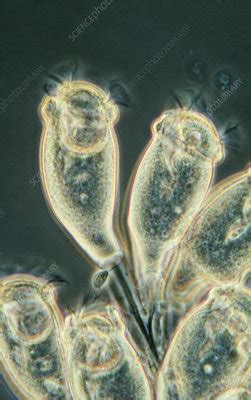  Zoothamnium: A Ciliate That Thrives On Aquatic Delights!